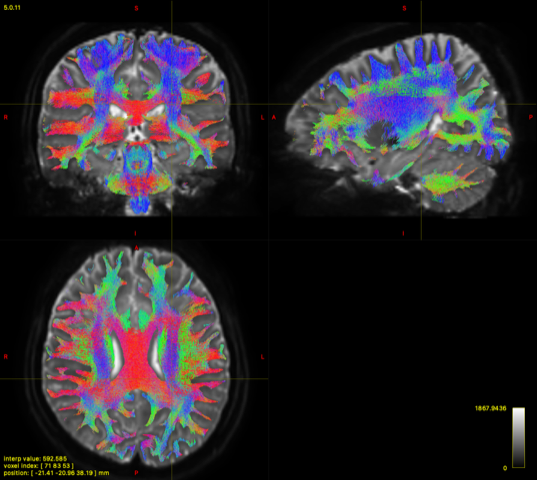 News and Highlights Kennedy Krieger Institute